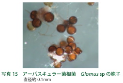 写真１５：アーバスキュラー菌根菌の胞子