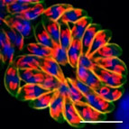 トキソプラズマの共焦点顕微鏡像<br>(Sugi T et al. Int J Parasitol Drugs Drug Resist. 5:1-8.)